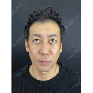 藤・ナチュレ美容クリニック 藤・ナチュレ美容クリニック 銀座院口コミ