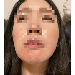 バタン美容整形外科口コミ