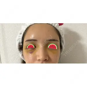 NARU Beauty Clinic NARU Beauty Clinic 【ナルクリ】 水戸院口コミ