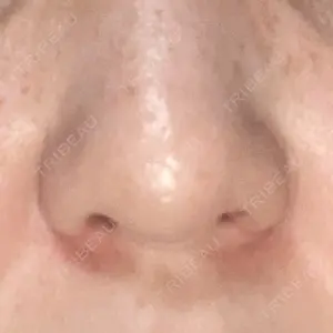 渋谷の森クリニック口コミ