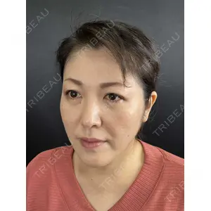 藤・ナチュレ美容クリニック 藤・ナチュレ美容クリニック 銀座院口コミ