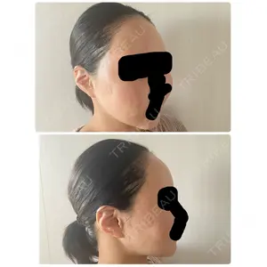 セギム美容整形外科口コミ