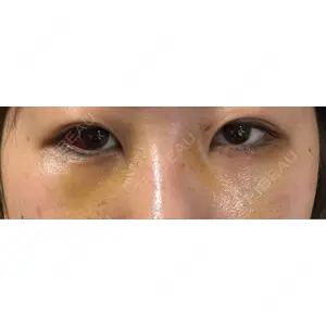APOLLO BEAUTY CLINIC口コミ