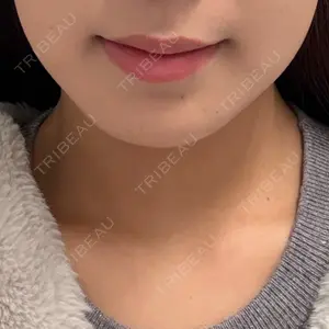 BiBiクリニック口コミ