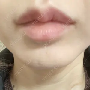 L‘amour clinic Tokyo【ラムールクリニック東京】口コミ