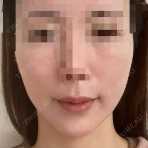 銀座マイアミ美容外科口コミ