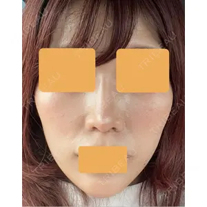 口コミ