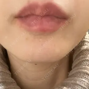 L‘amour clinic Tokyo【ラムールクリニック東京】口コミ