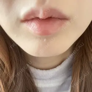 L‘amour clinic Tokyo【ラムールクリニック東京】口コミ