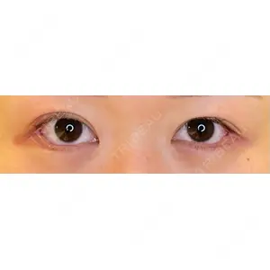 LOUIS CLINIC 二子玉川院【ルイクリニック】口コミ