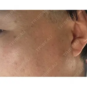 東京美容外科 東京美容外科 梅田院口コミ