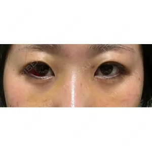 APOLLO BEAUTY CLINIC口コミ