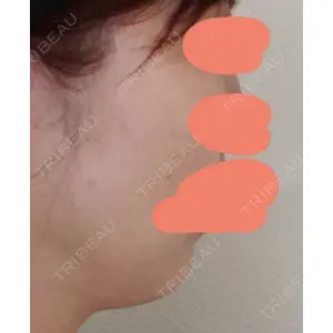 DMTC美容皮膚科 DMTC美容皮膚科 日本橋院口コミ