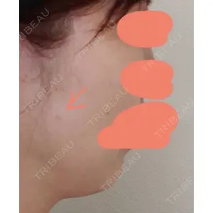 Mavie Beauty Clinic （マヴィービューティークリニック）口コミ