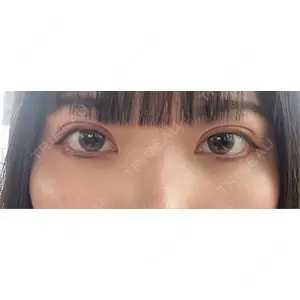 藤・ナチュレ美容クリニック 藤・ナチュレ美容クリニック 銀座院口コミ
