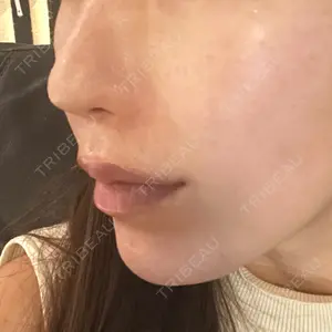 APスキンクリニック銀座口コミ