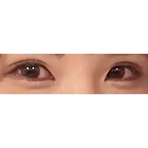 東京イセアクリニック口コミ