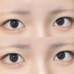 オアシス美容外科口コミ