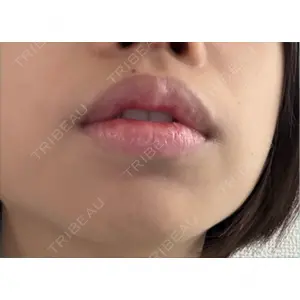 R Beauty CLINIC R Beauty CLINIC 銀座院口コミ