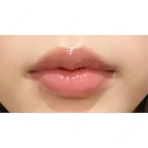 R Beauty CLINIC R Beauty CLINIC 銀座院口コミ