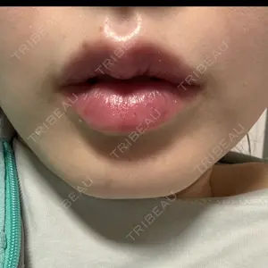 L‘amour clinic Tokyo【ラムールクリニック東京】口コミ