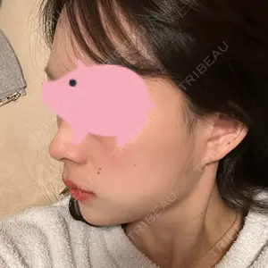 フィラークリニック フィラークリニック 名古屋栄院口コミ