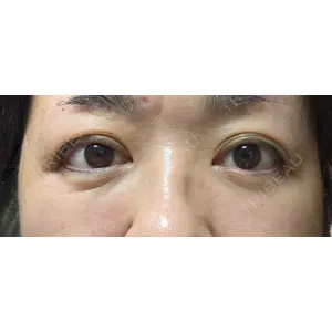 湘南美容クリニック 湘南美容クリニック 表参道院口コミ