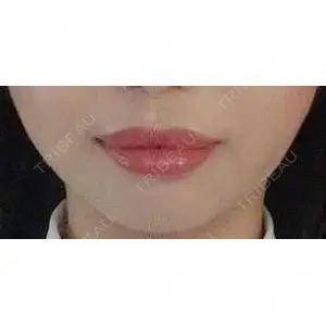 口コミ