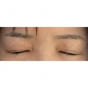 オアシス美容外科口コミ