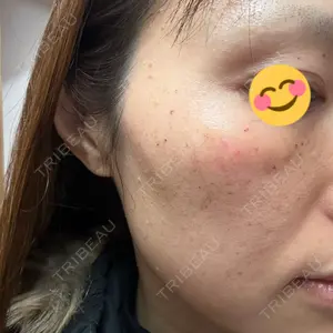 ルラ美容クリニック ルラ美容クリニック 札幌院口コミ