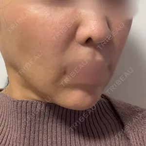 Tokyo Tensei Clinic Tokyo Tensei Clinic 銀座院口コミ