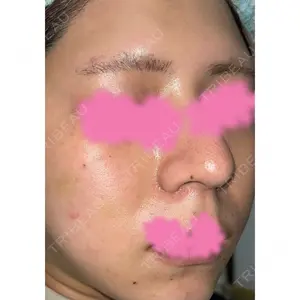 CIEL SKIN CLINIC（シエルスキンクリニック）口コミ