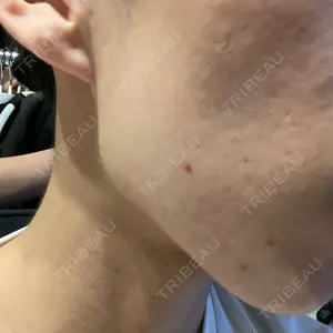 東京素肌クリニック 東京素肌クリニック 銀座本院口コミ