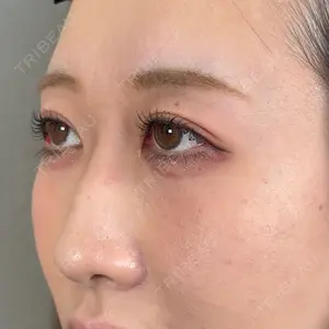 口コミ