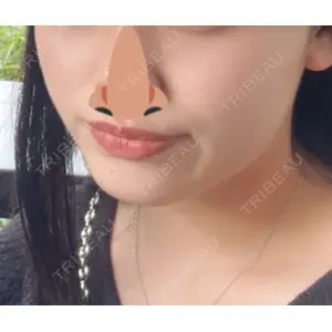 おおたかの森ビューティークリニック口コミ