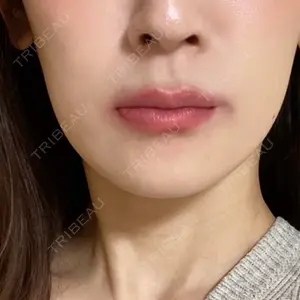 LOUIS CLINIC 二子玉川院【ルイクリニック】口コミ