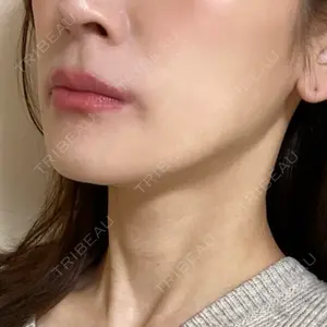LOUIS CLINIC 二子玉川院【ルイクリニック】口コミ