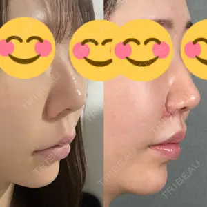 口コミ