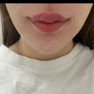 ルラ美容クリニック ルラ美容クリニック 大阪本院口コミ