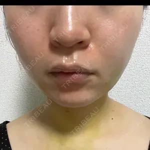 口コミ