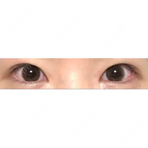 いちのせ形成外科・皮膚科 眼瞼＆フェイスクリニック口コミ