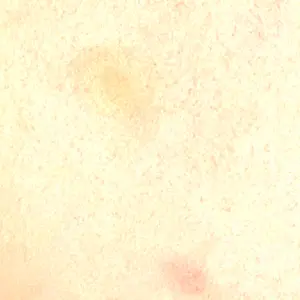 Fellez Clinic【フェルズクリニック】口コミ