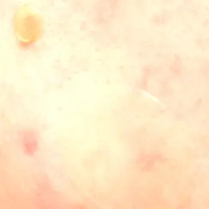 Fellez Clinic【フェルズクリニック】口コミ