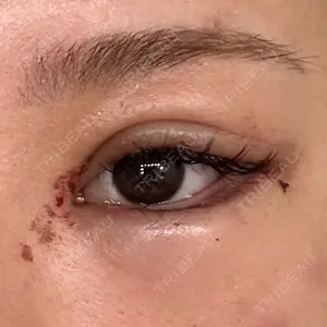 東京BELLEZZAクリニック口コミ