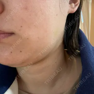 HELLATH CLINIC 新宿院口コミ