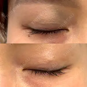 TCB東京中央美容外科 TCB東京中央美容外科 秋葉原院口コミ