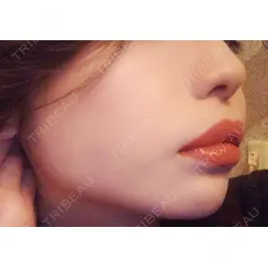 口コミ