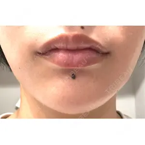湘南美容クリニック 湘南美容クリニック 新宿本院口コミ