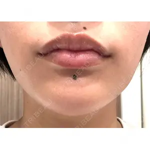 湘南美容クリニック 湘南美容クリニック 新宿本院口コミ