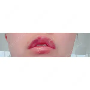 La Clinique La Clinique Shinjuku 【ラクリニック 新宿】口コミ